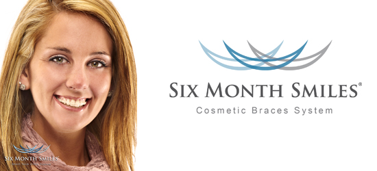 6 month smiles Stoke-on-Trent | Six month smiles Derbyshire | Inman aligner Derbyshire | Clearstep braces Stoke-on-Trent